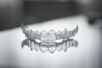 Invisalign aligners Tampa FL